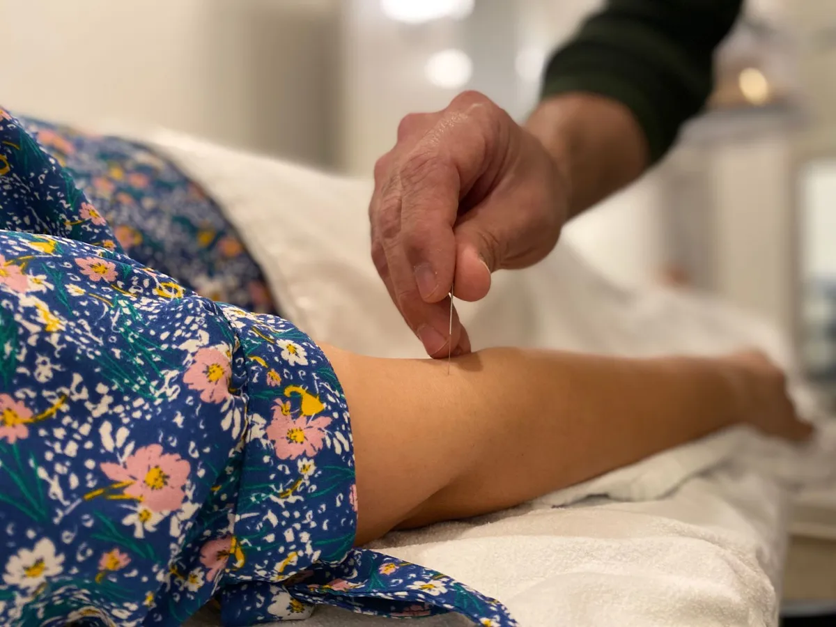 An acupuncturist's hand placing a needle on the arm of a patient in a floral dress